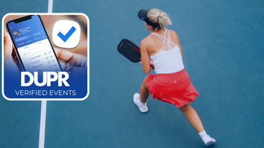 Say Goodbye to Sandbagging?